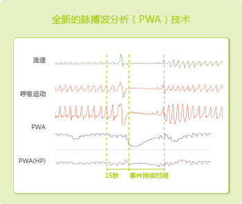 PWA技术-1